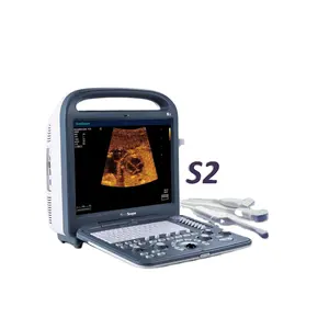 Macchina ad ultrasuoni Sonoscape S2 di marca famosa internazionale con varie applicazioni diagnostiche
