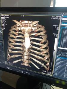 Veterinaire Ct Screener Supply Ctscreener Systeem Dr Xray Beeldvorming Van Dieren Veterinaire Ct Scanner Ultrasound Supply - Product Image 6