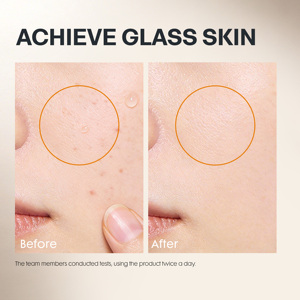 เซรั่มบำรุงผิวหน้าสูตรเฉพาะ ช่วยกระชับรูขุมขน ด้วย <span class=keywords><strong>BHA</strong></span> ไนอะซินาไมด์ ลดเลือนริ้วรอย ผสมว่านหางจระเข้ ควบคุมความมัน - Product Image 6