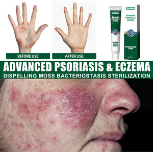 Limpiador <span class=keywords><strong>Facial</strong></span> Herbal con Licencia para el Cuidado de la Piel, para Psoriasis, <span class=keywords><strong>Dermatitis</strong></span>, Eccema, Picazón, Ungüento y Crema para Psoriasis - Product Image 4