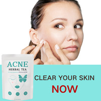 Thé Naturel OEM aux Herbes pour l'Élimination de l'Acné, Peau Éclatante, Santé Féminine, Peau Lisse, 20 Sachets de Thé, Produit Anti-Acné, Sachet de Thé Naturel