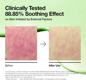 10% Azelaic & hyaluronic axit chất chống oxy hóa đốm đen loạ<span class=keywords><strong>i</strong></span> bỏ đỏ nhẹ nhàng trên khuôn mặt Toner Pad cho khuôn mặt Toner nhãn hiệu riêng - Product Image 2