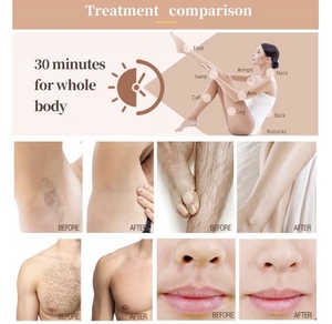 2025 Machine <span class=keywords><strong>Laser</strong></span> 755 808 1064 Machine à glace à trois longueurs d'onde pour l'épilation <span class=keywords><strong>Laser</strong></span> 3 vagues 755nm 808nm 1064nm pour 6 types de <span class=keywords><strong>peau</strong></span> - Product Image 6