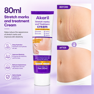 Akaril 80ml Crème Traitement <span class=keywords><strong>Vergetures</strong></span> Réduction Cicatrices Beurre de Karité Extrait d'Avocat Hydrate Répare Raffermit Corps <span class=keywords><strong>et</strong></span> Améliore l'Élasticité - Product Image 1