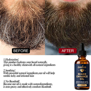 <span class=keywords><strong>น</strong></span>้ำมั<span class=keywords><strong>น</strong></span>บำรุงห<span class=keywords><strong>น</strong></span>วดเคราแบรนด์ส่วนตัว กระตุ้<span class=keywords><strong>น</strong></span>การเจริญเ<span class=keywords><strong>ติ</strong></span>บโตของขนบนใบหน้า หนวด<span class=keywords><strong>เครา</strong></span>หนาขึ้<span class=keywords><strong>น</strong></span> ดกดำขึ้น บำรุงรูขุมขน - Product Image 3