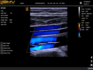 BPU60 3D <span class=keywords><strong>4D</strong></span> Couleur Doppler Échographie Balayage Vétérinaire Échographie Vétérinaire Scanner À Ultrasons <span class=keywords><strong>B</strong></span>/<span class=keywords><strong>W</strong></span> Couleur Doppler Machine Ecograph - Product Image 6