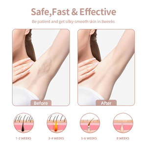 Appareil d'épilation IPL 3-en-1, épilateur sans douleur à refroidissement par glace pour une utilisation permanente à domicile, appareil portable multifonctionnel - Product Image 4