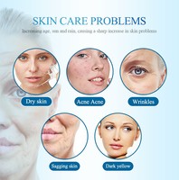 Machine professionnelle de beauté faciale de peau d'hydre de microdermabrasion de station thermale