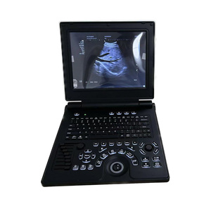 Échographe Doppler couleur portable pour hôpital, <span class=keywords><strong>3D</strong></span> 4D, ordinateur portable, machine d'échographie pour la grossesse humaine - Product Image 1