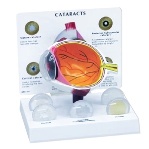 Modelos de Ojos de CIENCIA MÉDICA PARA glaucoma y cataratas - Product Image 1