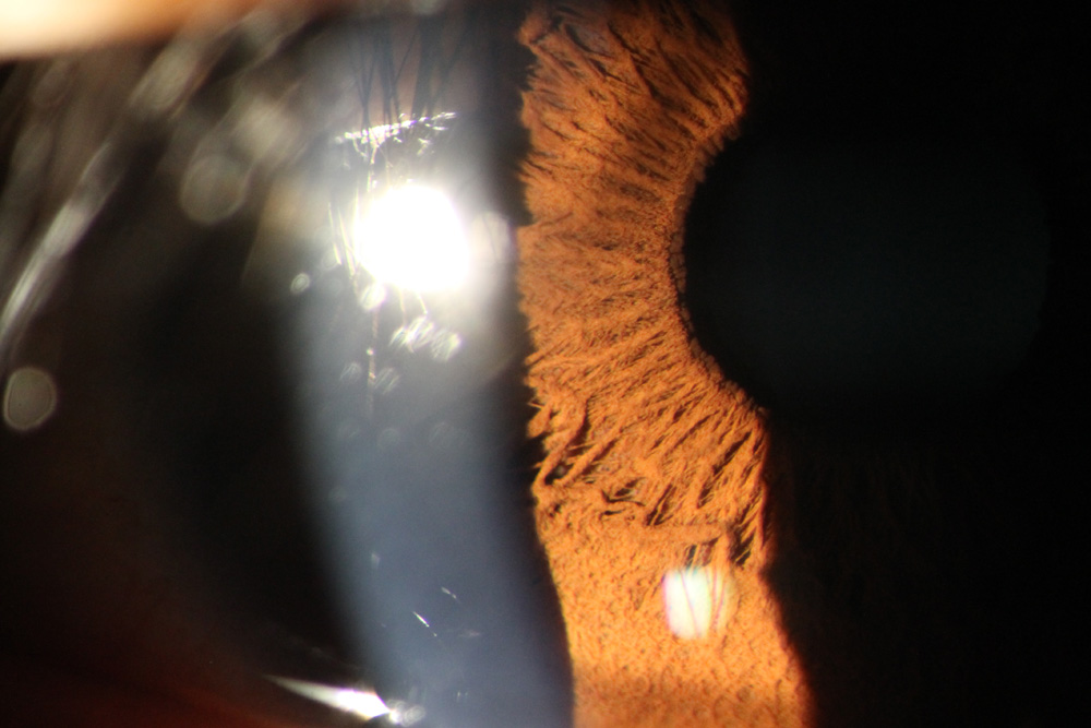 eye photography machine