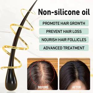 Minyak Mint perawatan rambut alami 100% Rosemary organik campuran herbal Label pribadi - Product Image 4