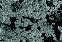 Fournisseurs de ciment réfractaire coulable, poudre d'aluminate de calcium amorphe 200 mesh pour accélérateur de ciment