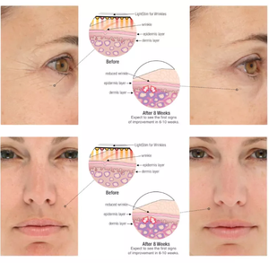 Kernel KN-7000A Vertriebspreis Bio <span class=keywords><strong>Light</strong></span> LED Gesichtsbehandlung gerät led rotes Licht Augenpflege Therapie ems massage - Product Image 2