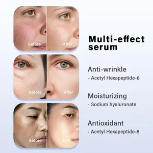OEM ODM atacado cuidados com a pele ácido hialurônico anti-idade niacinamida essência ácido hialuronato acetil Hexapeptídeo-8 para soro facial