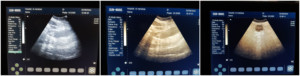 15 "Touchscreen Medische Scanner Draagbare Tablet Model Basis Ob Gyn Vasculaire Portatil Scanapparatuur - Product Image 6