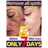 Crème éclaircissante anti-taches à l'astragale pour le visage – Élimine les taches brunes, le mélasma, atténue la mélanine, les cicatrices d'acné, anti-âge, illumine la peau noire