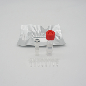PCR Fluorescent Probe <strong>Method</strong> Parrot Gender <strong>Nucleic</strong> <strong>Acid</strong> <strong>Detection</strong> Kit