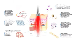Máquina de Láser Diodo para Fisioterapia del Dolor de 980nm + 1064nm + 810nm para Uso Comercial - Product Image 3