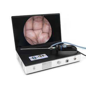 Histeroskopi ENT laparoskopi tıbbi 15.6 sistemi için soğuk ışık kaynağı ile endoskopi kamerası inç 4 in 1 endoskop kamera sistemi - Product Image 2