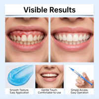 Gel de réparation dentaire professionnel pour soins bucco-dentaires, gel de réparation parodontale doux au goût menthe fraîche, offre un gel réparateur pour les dents