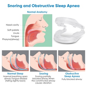 Dispositivos Anti Ronquidos, Protector <span class=keywords><strong>Bucal</strong></span> Ajustable y Reutilizable, Solución Contra los Ronquidos - Product Image 4