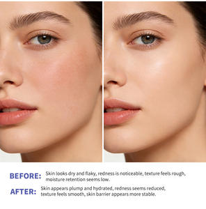 <span class=keywords><strong>Crema</strong></span> Facial con Triple Péptido Lipídico, Hidratante Intensa, Suavizante, Fortalece la Barrera Cutánea, Ilumina el Tono, Apta para Todo Tipo de Piel - Product Image 3