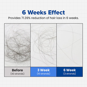 Popular Recomendar Champú para el cuidado del cabello Champú para Peluqueros Champú profesional - Product Image 6