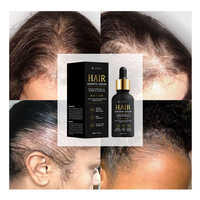 Kit de croissance de cheveux d'huile de sérum de croissance de barbe avec rouleau de Derma biotine plus épais cheveux plus pleins repousse empêche l'amincissement de perte de cheveux de cuir chevelu