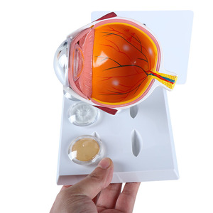 Modelos de Ojos de CIENCIA MÉDICA PARA glaucoma y cataratas - Product Image 6