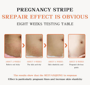 <span class=keywords><strong>Meilleure</strong></span> vente en gros crème réparatrice <span class=keywords><strong>Anti</strong></span>-vergetures à base de plantes biologique, Gel efficace pour l'élimination des cicatrices profondes - Product Image 2