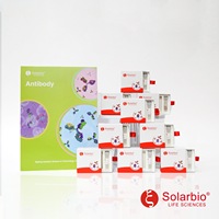 Kit de Tinción de Melanina de Alta Calidad Solarbio (Método de Sulfato de Ferro) para Investigación Científica