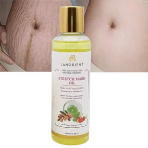 Crème de traitement de soins de la peau d'<span class=keywords><strong>huile</strong></span> essentielle de dissolvant de vergetures <span class=keywords><strong>pour</strong></span> l'élimination des vergetures - Product Image 1