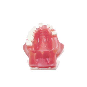 Hoogwaardig tandmodel voor onmiddellijke implantatopraktijk, geschikt voor demonstraties bij tandartsen en studententraining - Product Image 2