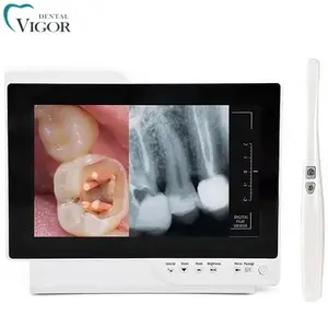 منظار داخل الفم رقمي مع جهاز مراقبة لطب الأسنان التنظير الداخلي للفم