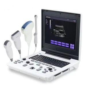 Mesin pemindai <span class=keywords><strong>Ultrasound</strong></span> Keyboard penuh, peningkatan baru diagnostik gema Notebook Digital B - Product Image 1