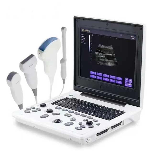 New Upgrade Human Use Diagnostic Echo Notebook Digital B Full Keyboard Ultrasound Scanner Machine