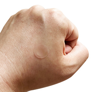 <span class=keywords><strong>Patch</strong></span> anti-acné invisible ultra-mince à 15 <span class=keywords><strong>points</strong></span> <span class=keywords><strong>Patch</strong></span> hydrocolloïde <span class=keywords><strong>pour</strong></span> <span class=keywords><strong>les</strong></span> soins de la peau <span class=keywords><strong>Patch</strong></span> anti-acné - Product Image 4