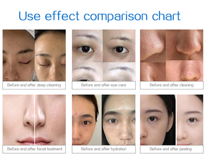 เครื่องทรีตเมนต์ผิวหน้าไฮโดรเดอร์มาเบรชัน14 in 1แบบขายส่งเครื่องลอกผิวหน้าด้วยน้ำเจ็ต - Product Image 6