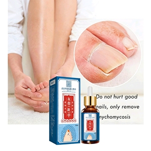Fortalecedores de Uñas Herbales OEM, Líquido para el Cuidado de las Uñas con Extracto de Plantas, Nutre <span class=keywords><strong>la</strong></span> Superficie de las Uñas, Suaviza <span class=keywords><strong>la</strong></span> Cutícula, Cuidado Diario para <span class=keywords><strong>la</strong></span> <span class=keywords><strong>Piel</strong></span> Delgada, 30 ml - Product Image 1
