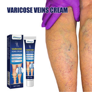 Crema de hierbas de 20g para suministro de atención médica <span class=keywords><strong>venas</strong></span> varicosas flebitis araña <span class=keywords><strong>venas</strong></span> angiitis crema - Product Image 2
