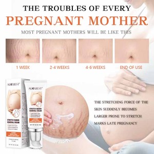 Kem Trị Sẹo Hiệu Auquest, Trị Rạn Da, Trị Sẹo Do Rạn Da - Product Image 5