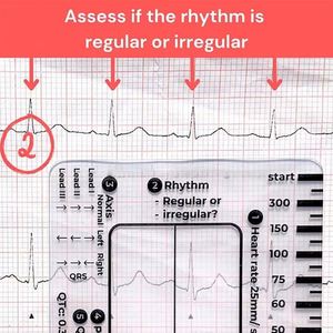 Regla de 7 Pasos para ECG, Regla de ECG para Interpretación, Herramienta de Medición de Plástico, Calibrador Transparente para EKG, Referencia de Enfermería - Product Image 3