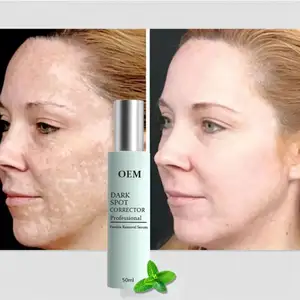 No.1 Supplier For Vietnam Strong Effects Powerful Freckle Cream Remove Melasma Acne Spots Pigment Melanin Whitening Moisturizing