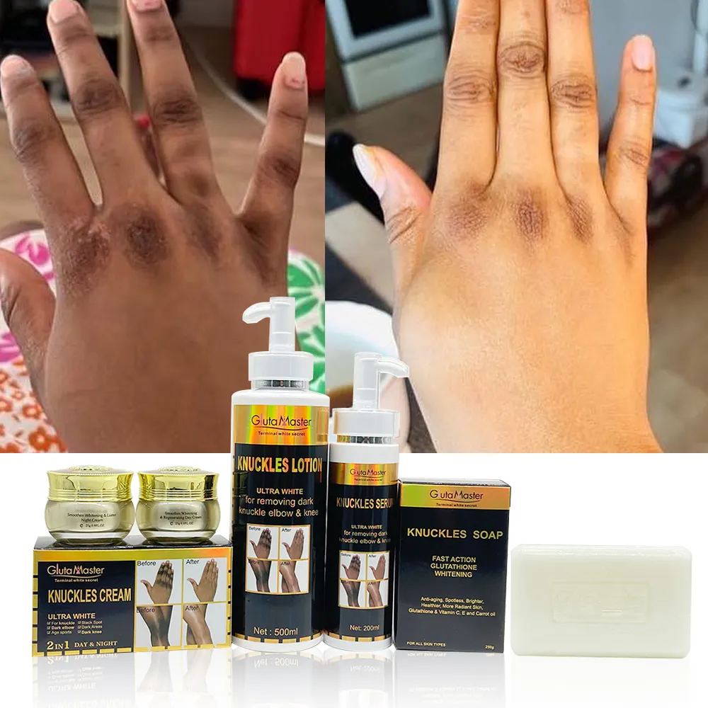 Gluta Master Dark Knuckle Set Sterke Whitening Verwijderen Donkere Vlek Voor Knuckle & Tenen Elbow & Knee Zwarte Vrouwen Huid set