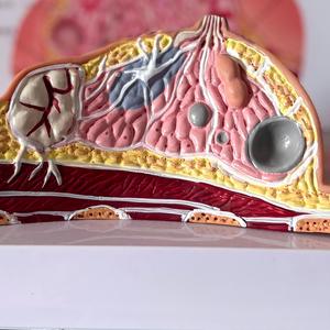 Tıbbi Öğretim İçin Yaygın Patolojileri İçeren İnsan Meme Anatomisi Modeli - Product Image 5