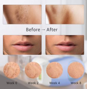 เครื่องกำจัดขน IPL แบบพกพา T3 ใช้ได้กับปลั๊ก UK/AU/US ทนทาน 3-in-1 สำหรับใต้วงแขน ริมฝีปาก ใบหน้า ฟื้นฟูผิว กำจัดขน ใช้ในบ้าน ช่วยให้ผิวขาวกระจ่างใส - Product Image 3