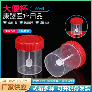 Recipiente de plástico para muestras de heces Jiangsu Kangmeng, hecho a medida con cuchara para la recolección de muestras. - Product Image 3