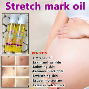 Hoge Kwaliteit 200Ml Lavendel Buikverzorgingsolie <span class=keywords><strong>Bio</strong></span> Verhelderende Huidverzorging Essentieel Voor Striae Verlichting Littekens Oranje Gember - Product Image 3