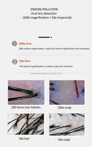 Portable 200X analyseur de cuir chevelu et de cheveux appareil de test de portée de cheveux - Product Image 3